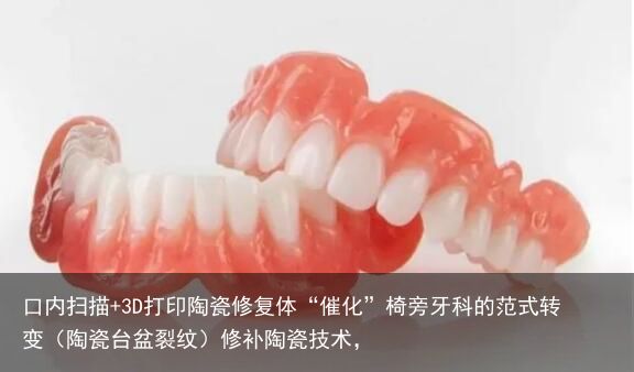 口内扫描+3D打印陶瓷修复体“催化”椅旁牙科的范式转变（陶瓷台盆裂纹）修补陶瓷技术，