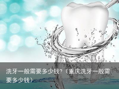 洗牙一般需要多少钱?（重庆洗牙一般需要多少钱）
