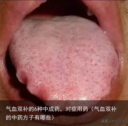 气血双补的6种中成药，对症用药（气血双补的中药方子有哪些）