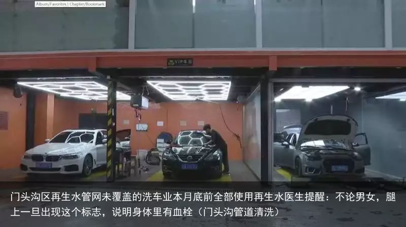 门头沟区再生水管网未覆盖的洗车业本月底前全部使用再生水医生提醒：不论男女，腿上一