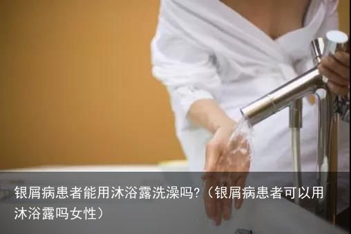 银屑病患者能用沐浴露洗澡吗?（银屑病患者可以用沐浴露吗女性）