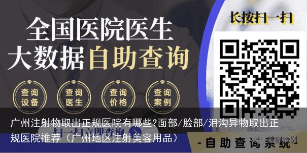 广州注射物取出正规医院有哪些?面部/脸部/泪沟异物取出正规医院推荐（广州地区注射