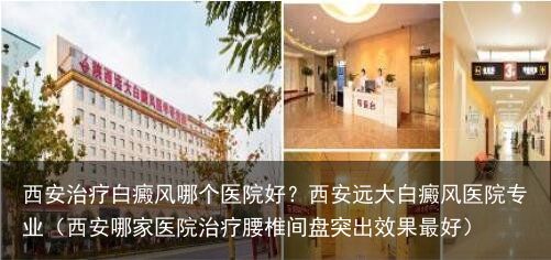西安治疗白癜风哪个医院好？西安远大白癜风医院专业（西安哪家医院治疗腰椎间盘突出效
