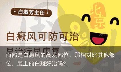 面部是白癜风的高发部位，那相对比其他部位，脸上的白斑好治吗?